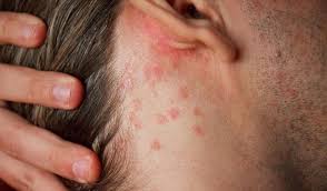 massage a domicile bien etre bordeaux peau belle peau microbiote